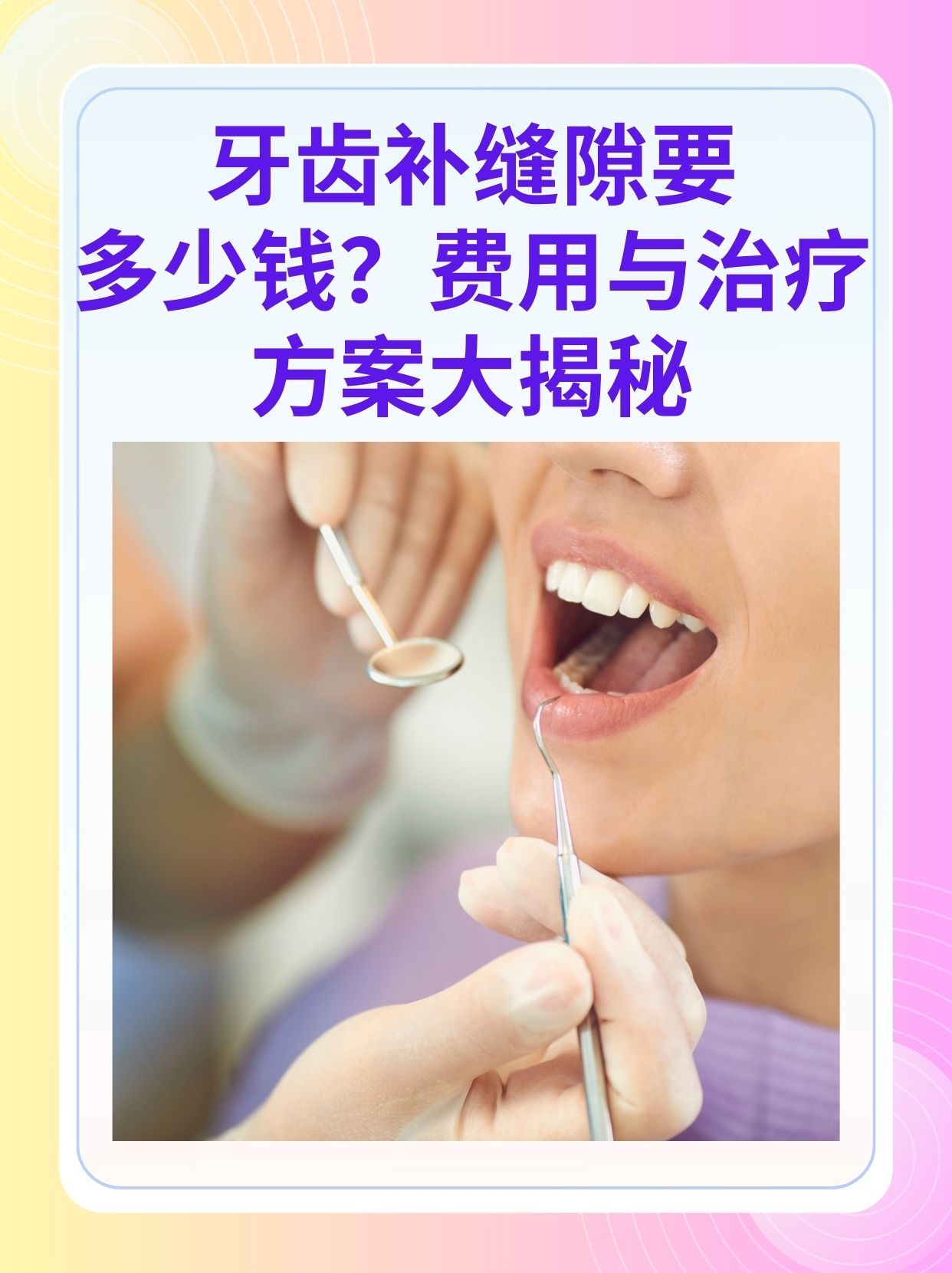 宁德补牙医保可以报销吗(补牙医保可以报销吗 哪些可以报销呢)